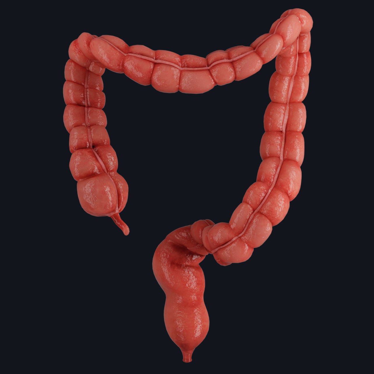 Large Intestine