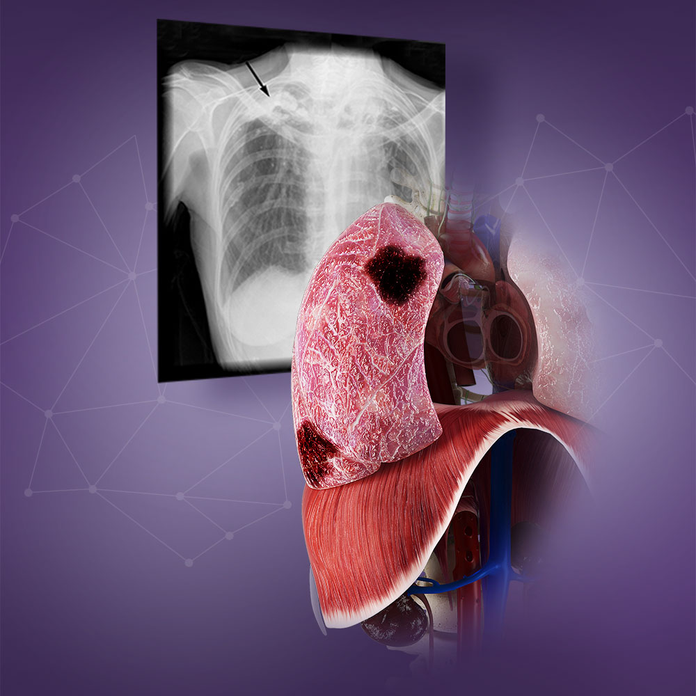 course poster