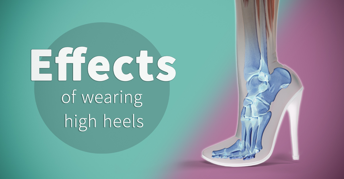 Effects of wearing high heels