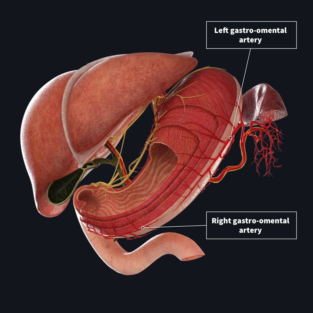 A stomach with layers removed showing the left gastro-omental artery and right gastro-mental artery bringing blood supply to the stomach
