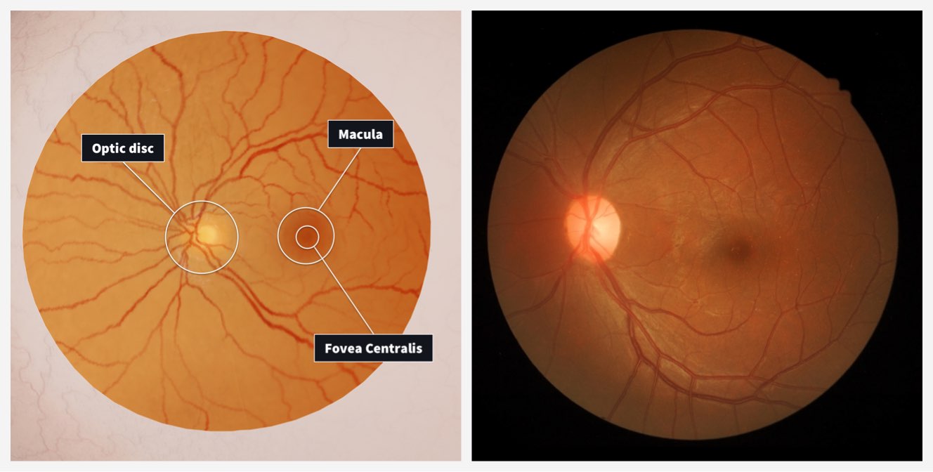 Retina correlation