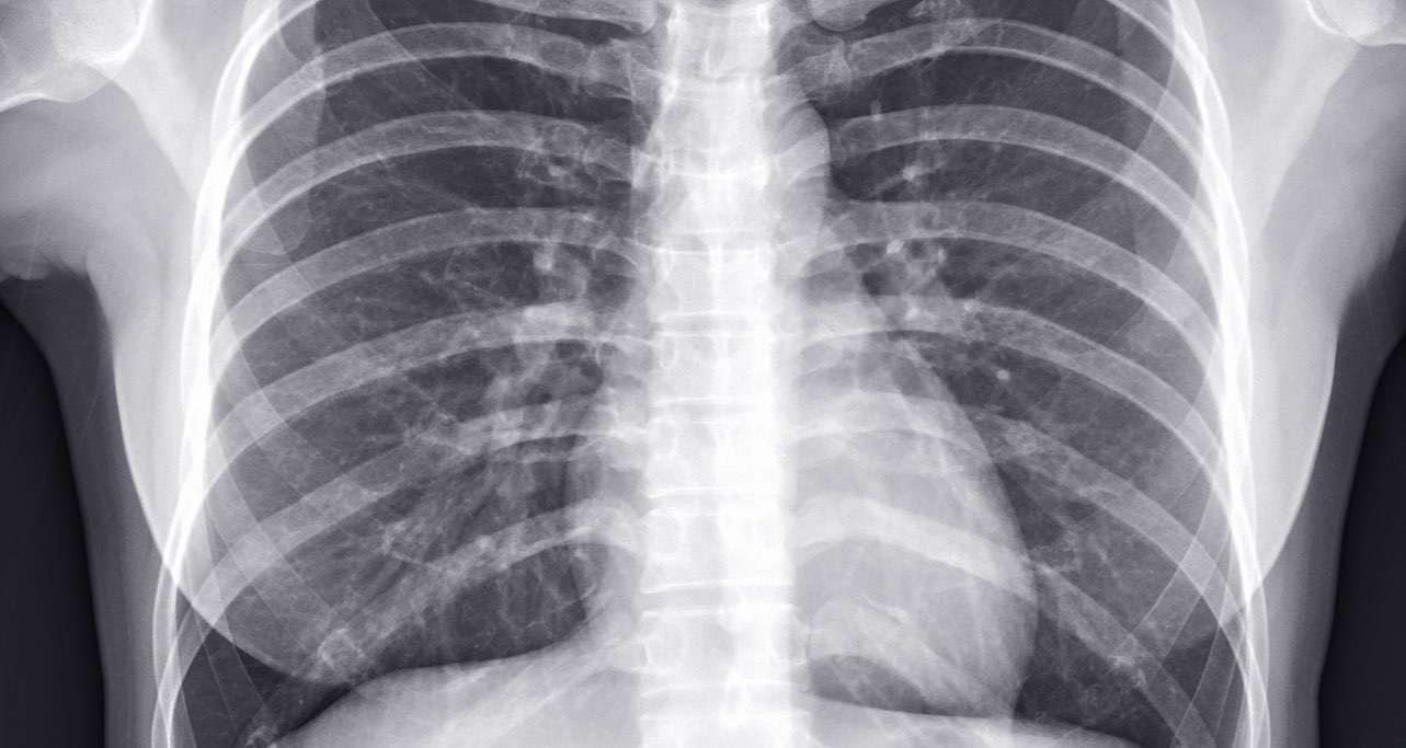 The anatomy of radiography