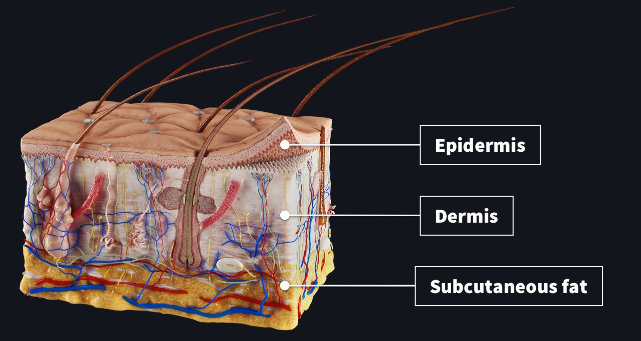 Types of injection