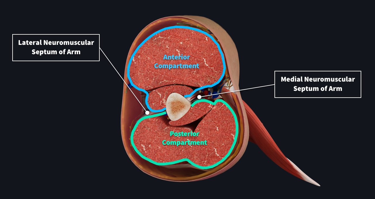 Cross section of the upper arm, showing the muscles of the anterior compartment and the posterior compartment