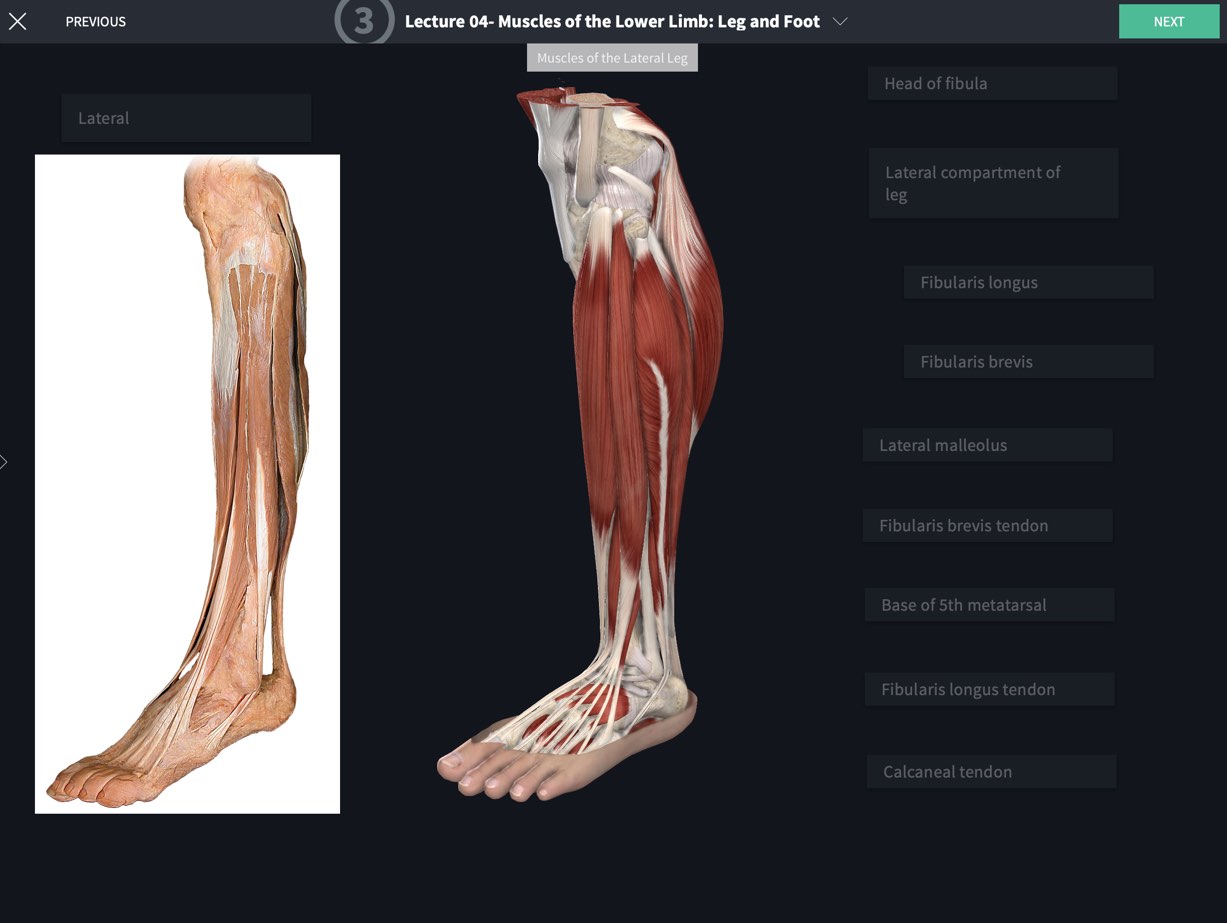 Cadaveric Lab: Skeletal And Muscular Systems - Complete Anatomy