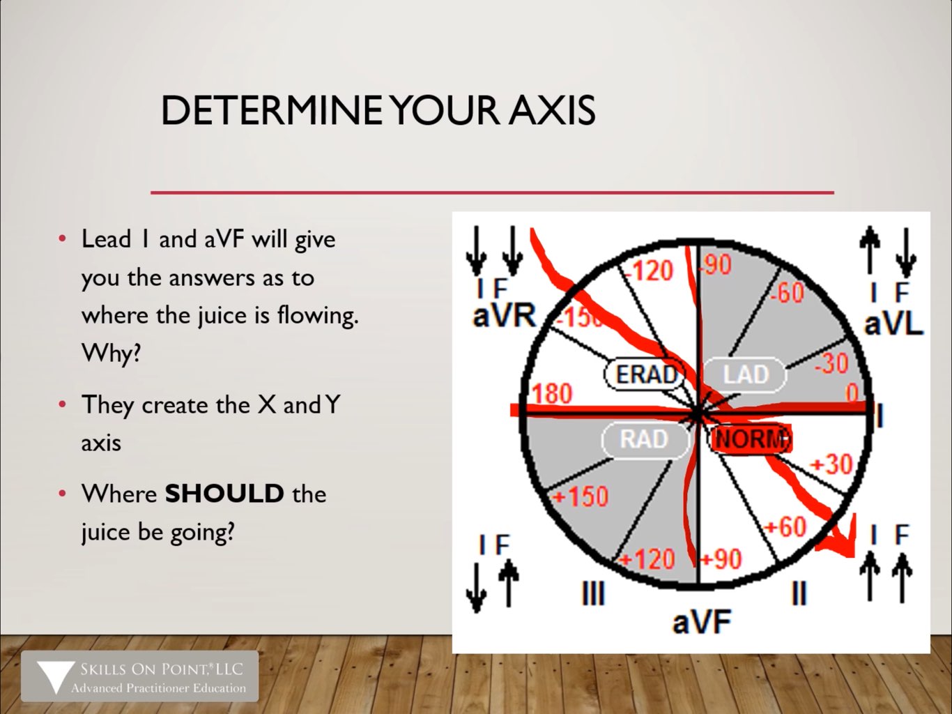 Basic 12 Lead EKG Interpretation