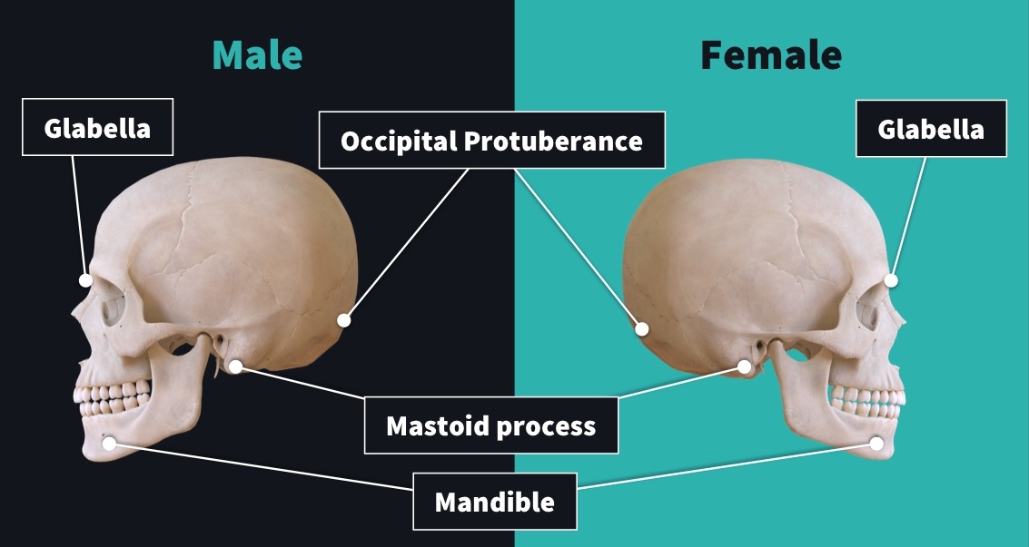 skull