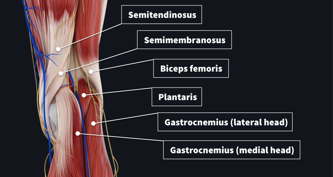 The borders of the popliteal fossa with the semitendinosus, semimembranosus, biceps femurs, plantaris and gastrocnemius labelled