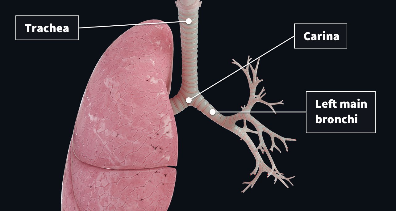 How the ventilator works