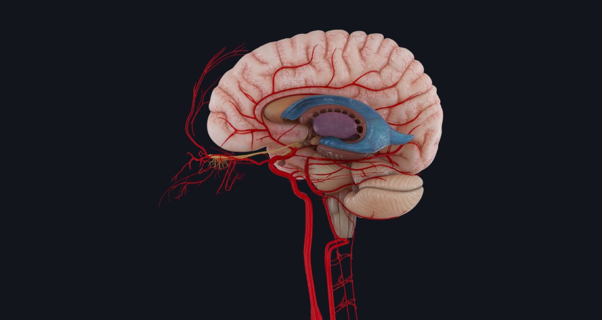 What happens during a stroke